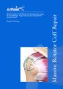 Massive Rotator Cuff Repair and Augmentation using the SpeedBridge™ and ArthroFlex™ Dermal Matrix